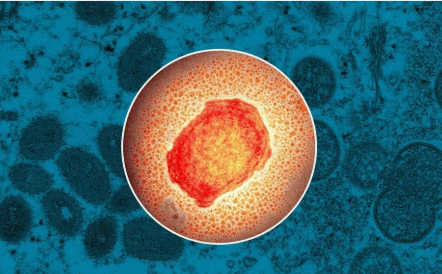 Ο ΠΟΥ ζητά βοήθεια: Ψάχνει νέο όνομα για την Ευλογιά των Πιθήκων