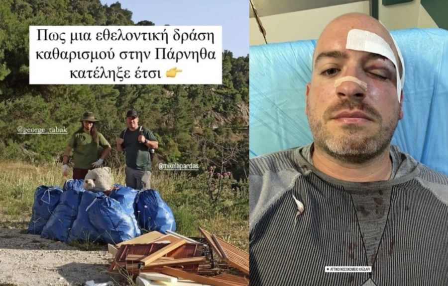 Τρόμος στην Πάρνηθα: Επιτέθηκαν και μαχαίρωσαν εθελοντές που καθάριζαν την περιοχή - Δείτε φωτογραφίες