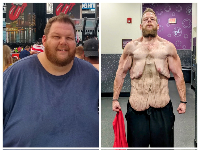 «Είναι πολύ δύσκολο να μοιραστώ μια φωτογραφία χωρίς πουκάμισο»: Έχασε 150 κιλά σε 23 μήνες