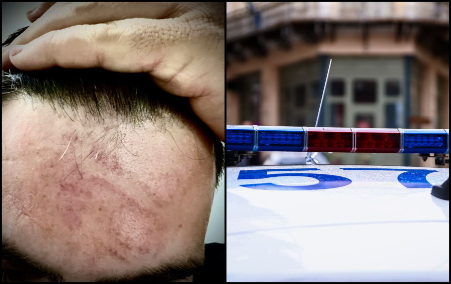 Του είπε πως είναι αστυνομικός για να τον ηρεμήσει κι εκείνος... φώναξε τους γιους του και τον «πλάκωσαν»