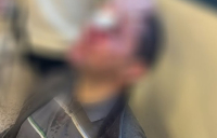 Πώς έγινε η επίθεση στη Νομική: «Τον χτυπούσαν με κράνη και γκλοπ, δεν έχω ξαναδεί τόση βία»