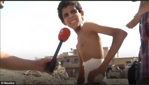 Μοσούλη: Σκελετωμένο αγόρι κρυβόταν τραυματισμένο επί 20 ημέρες από το ISIS