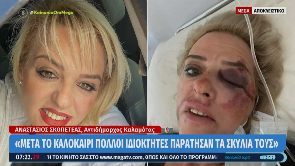 Σώθηκε «από θαύμα» όταν της επιτέθηκε άγρια αγέλη σκύλων στην Καλαμάτα (βίντεο)