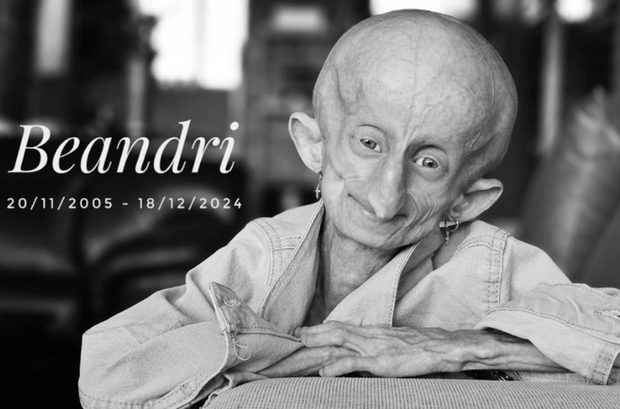 Πέθανε στα 19 της χρόνια η Beandri Booysen - Το κορίτσι που έπασχε από προγηρία