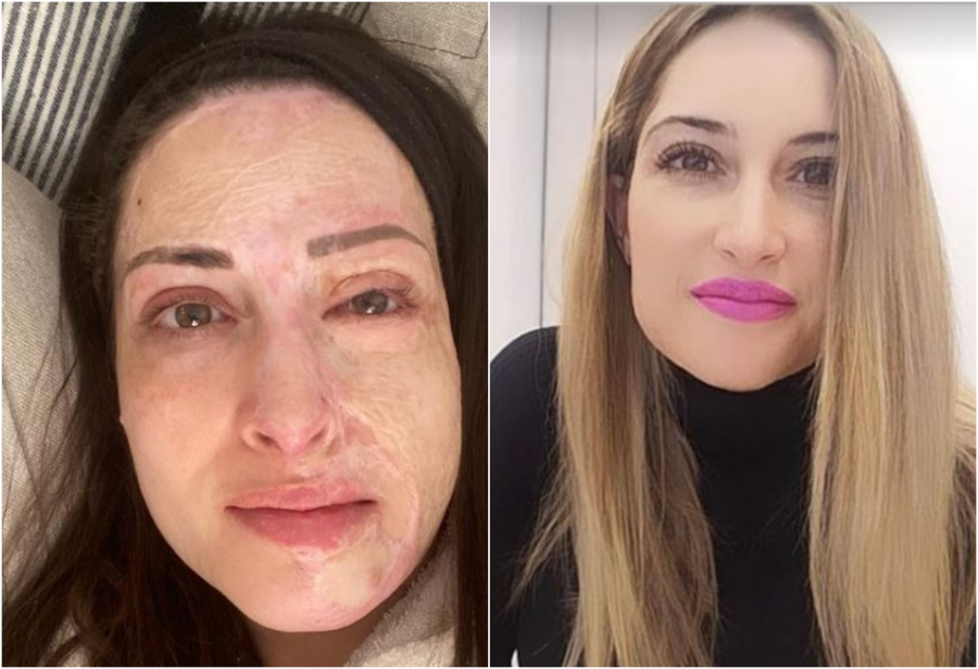 Ιωάννα Παλιοσπύρου: Η συγκλονιστική ανάρτηση για τα 3 χρόνια από την επίθεση με βιτριόλι