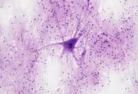 Νέα τεχνική χαρτογράφησης του εγκεφάλου αποκαλύπτει τα μυστικά του