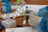 Πότε κάνουμε τεστ αν είχαμε επαφή με επιβεβαιωμένο κρούσμα κορονοϊού