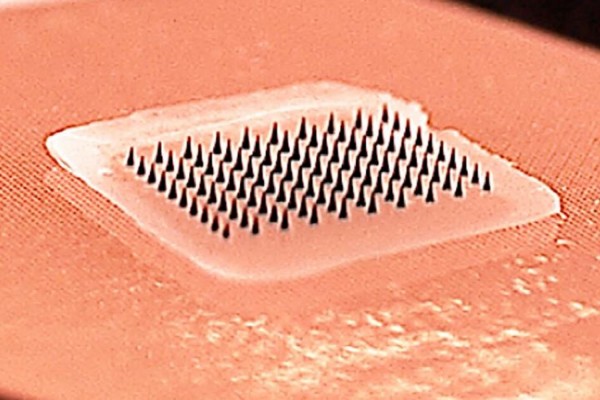 «Τσιρότο» εμβολιασμού μπορεί να αντικαταστήσει τις ενέσεις στο μέλλον