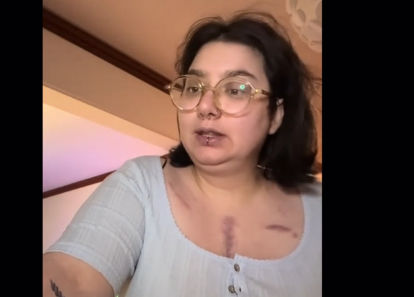 Μια ζωή γεμάτη μάχες: Η 27χρονη Ελισάβετ παλεύει με σπάνιο σύνδρομο αλλά και με τις στρεβλώσεις του ΕΣΥ