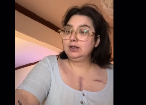 Μια ζωή γεμάτη μάχες: Η 27χρονη Ελισάβετ παλεύει με σπάνιο σύνδρομο αλλά και με τις στρεβλώσεις του ΕΣΥ