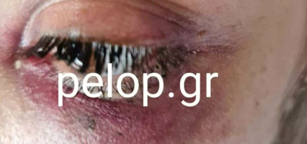 Πλάκωσε στο ξύλο την πρώην και συνελήφθη, «θα σε σκοτώσω όταν βγω»