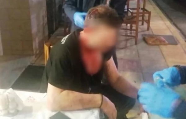 Αγρίνιο: «Άνοιξαν» το κεφάλι επαγγελματία με γκλοπ επειδή δεν τους άρεσε το φαγητό