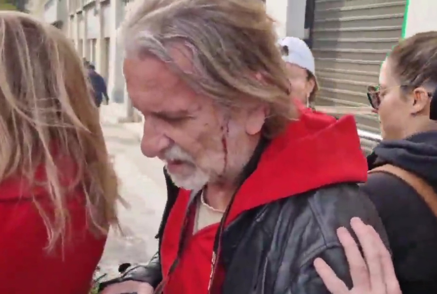 Σύνταγμα: Η στιγμή του τραυματισμού του φωτορεπόρτερ Μάριου Λώλου (Βίντεο)