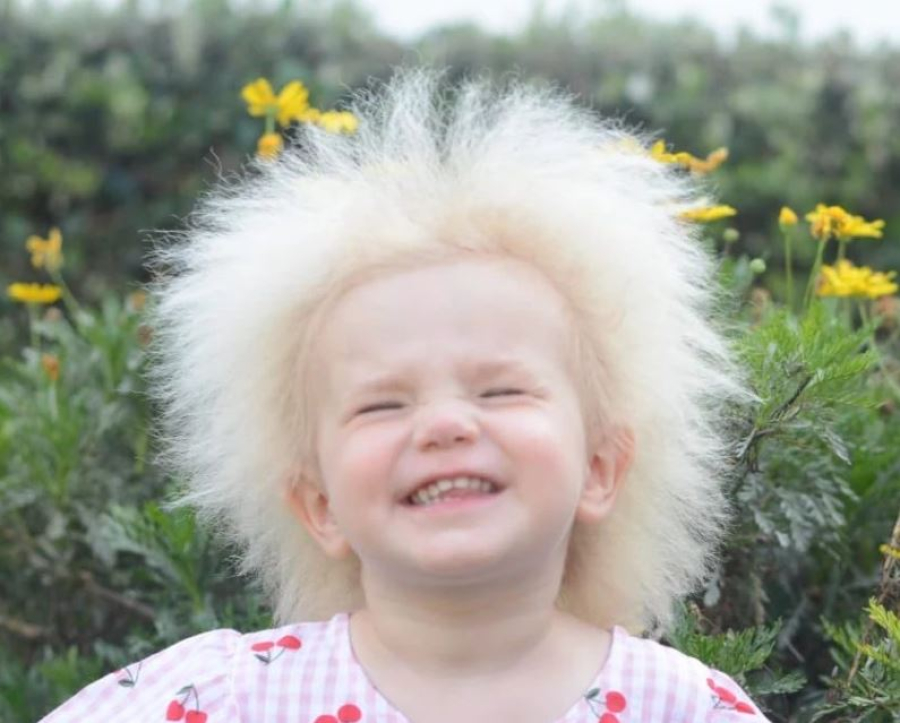 Εσείς γνωρίζετε το σύνδρομο των αχτένιστων μαλλιών;