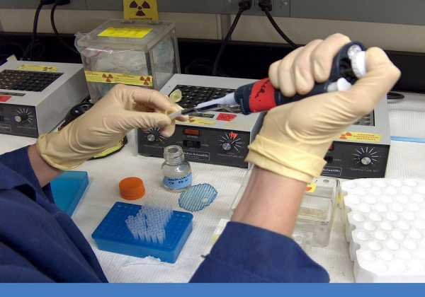 Οι ηπατίτιδες B και C συνδέονται με αυξημένο κίνδυνο για Πάρκινσον