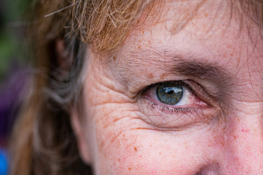 Χάρβαρντ: 2 κρέμες και 2 tips για να ξεφορτωθείς τις σακούλες κάτω από τα μάτια