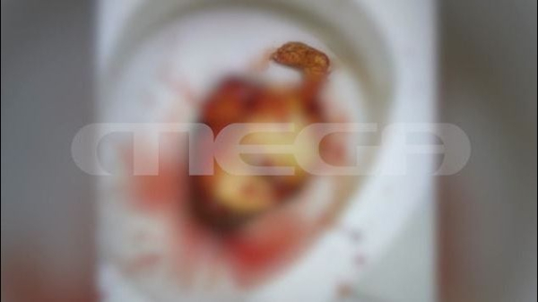 Απίστευτο περιστατικό στο ΚΑΤ: Βγήκε από την τουαλέτα μέσα στα αίματα... και είχε γεννήσει, «δεν ήξερα καν ότι είμαι έγκυος» (βίντεο)