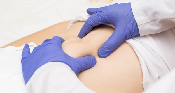 Βουβωνοκήλη: Συμπτώματα, κίνδυνοι και θεραπεία