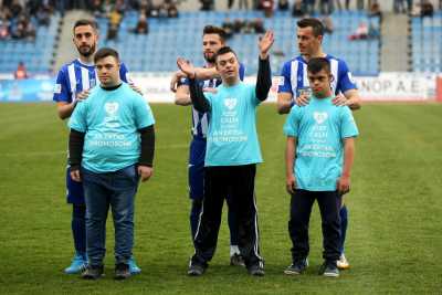 ΕΣΑμεΑ: 21 Μαρτίου Παγκόσμια Ημέρα για το Σύνδρομο Down