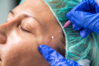 Botox: το δηλητήριο της…ομορφιάς!