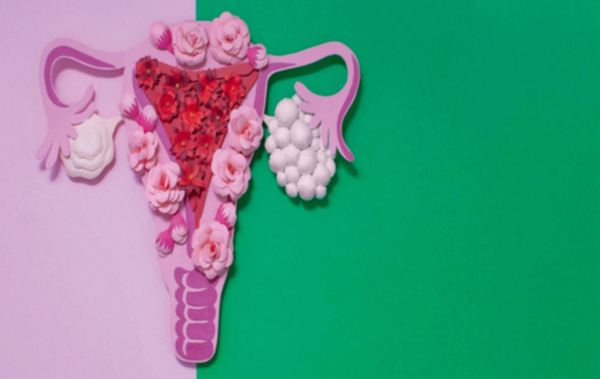 Σύνδρομο πολυκυστικών ωοθηκών: Η επίδραση του σωματικού βάρους