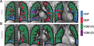 Radiological Society of North America (RSNA)