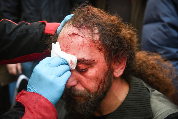 ΕΦΕ και ΠΟΣΠΕΡΤ καταγγέλλουν τις επιθέσεις και κάνουν λόγω για «Δολοφονική επίθεση»