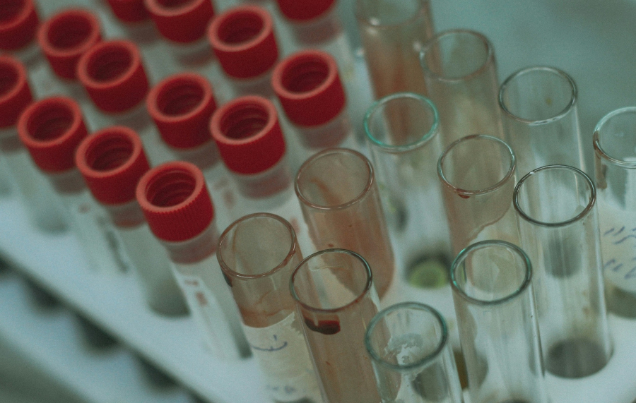 H αιματολογική εξέταση που πρέπει να κάνετε αν είστε άνω των 50, σύμφωνα με έναν καρδιολόγο