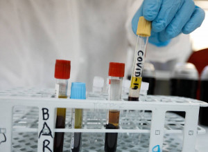 CDC: Ο κορονοϊός είναι τουλάχιστον πέντε φορές πιο φονικός από τη γρίπη για τους νοσηλευόμενους
