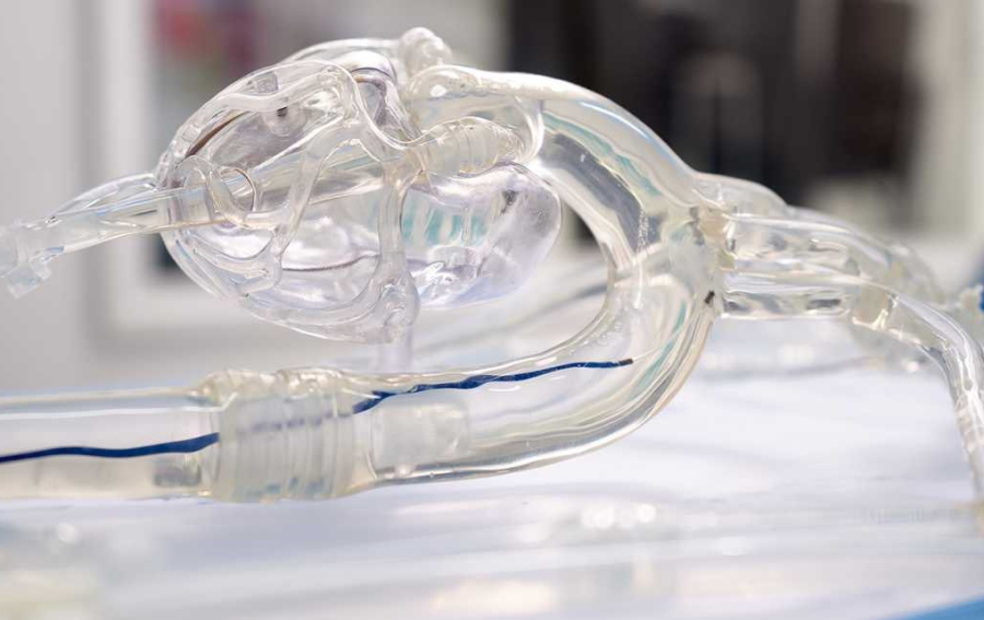 Νέος τρόπος αντιμετώπισης εγκεφαλικού επεισοδίου, μπαίνοντας στον εγκέφαλο γρήγορα και με ακρίβεια (βίντεο)