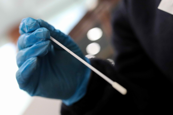 ΕΟΔΥ: Tα σημεία για rapid test κορoνοϊού σήμερα