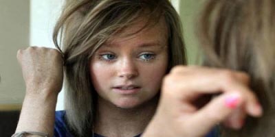 Δύο αδελφές αλλάζουν δέρμα κάθε μέρα απίστευτο!! και όμως....