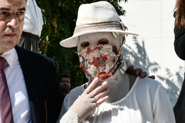 Βιτριόλι: Η πρώτη συνέντευξη της Ιωάννας Παλιοσπύρου: Δεν είχα δει την εικόνα μου, γυρνούσα το κεφάλι από την άλλη (βίντεο)