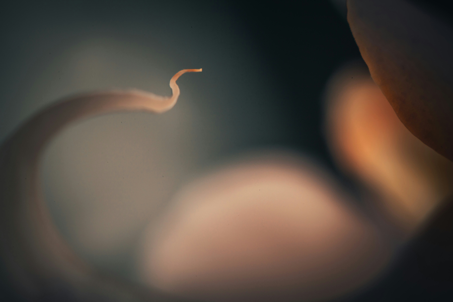 18 παιδιά στην Ελλάδα από τον δότη με την καρκινογόνα μετάλλαξη: Ανησυχία για τα κενά ασφαλείας