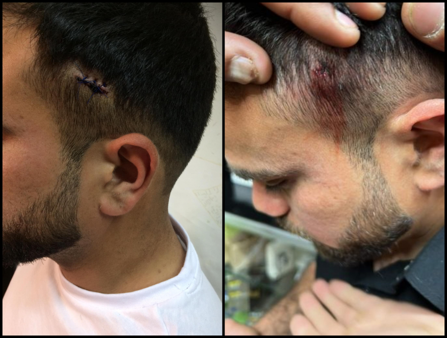 Καταγγελία για ρατσιστική επίθεση στα Πατήσια: «Φώναξε "γ@μώ τους μουσουλμάνους" και πυροβόλησε 26χρονο εργάτη»