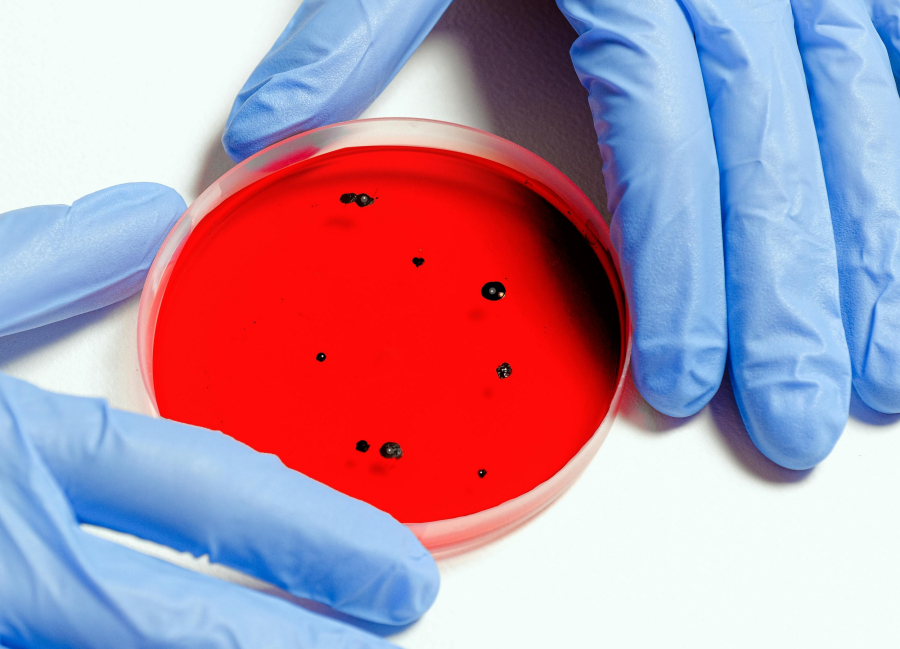 Παρβοϊός Β19: Πώς μεταδίδεται και ποια είναι τα συμπτώματα - 7 ερωτήσεις και απαντήσεις