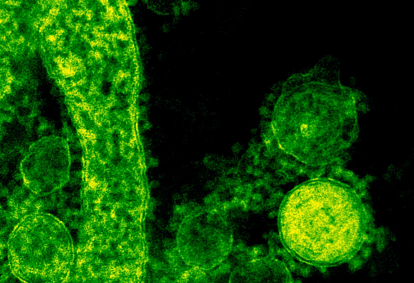 Ένα σπάνιο αλλά επικίνδυνο σαρκοφάγο βακτήριο μολύνει τους κατοίκους της Φλόριντα: Προκαλεί γάγγραινα