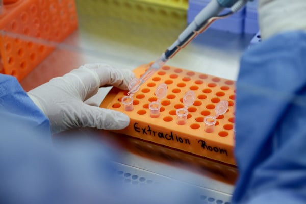 Οι επιστήμονες το ξεκαθάρισαν: Δεν χρειάζεται τεστ Covid για το αντιγριπικό εμβόλιο