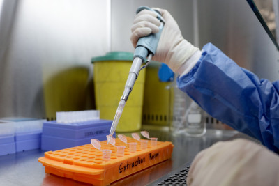 Εμβόλιο για κορονοϊό: Στα «πρόθυρα σημαντικής ανακάλυψης» η CureVac