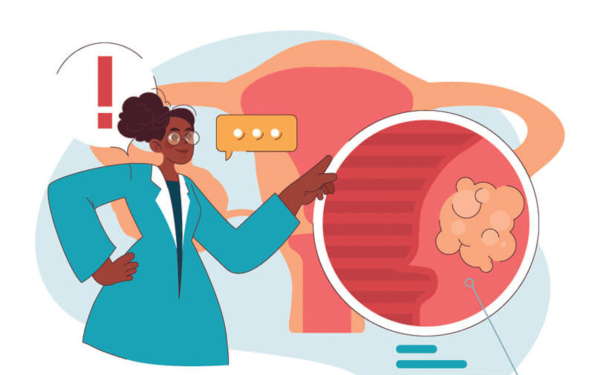 Ινομυώματα: Συμπτώματα, διάγνωση και αντιμετώπιση με εμβολισμό