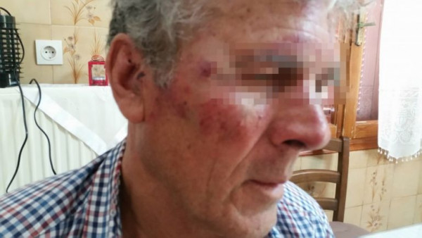 Ηλικιωμένος κατήγγειλε ότι δέχθηκε επίθεση από Τούρκους επειδή άκουγε εκκλησιαστικούς ύμνους