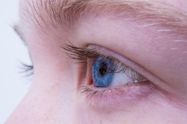 Τι σημαίνει για την υγεία σας αν πέφτουν οι βλεφαρίδες σας