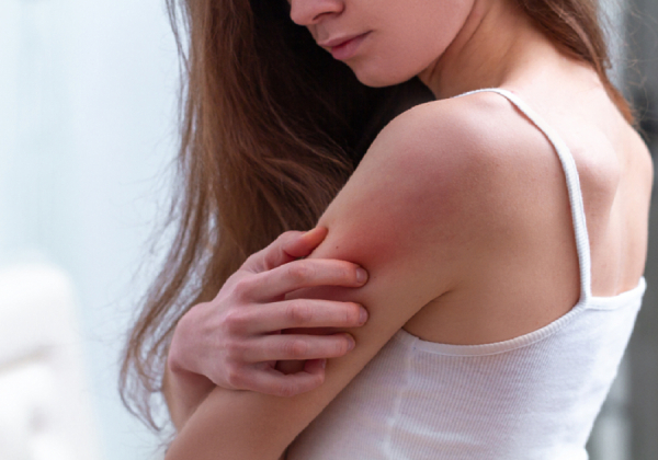 Αναφυλαξία και αλλεργικό σοκ: Πότε μια αλλεργία γίνεται απειλητική για την ζωή