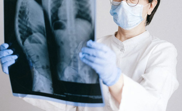 «Λευκή πνευμονία»: Ποια είναι τα χαρακτηριστικά της