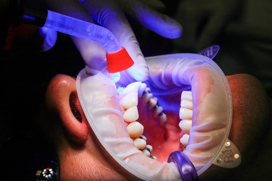 Dentist Pass με νέους δικαιούχους: Πότε ανοίγουν οι αιτήσεις για το voucher