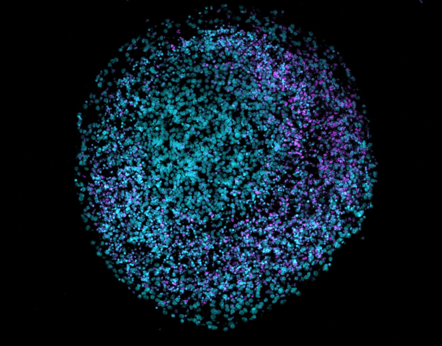 Οργανοειδής νοημοσύνη ή αλλιώς η ευφυΐα σε ένα… πιάτο