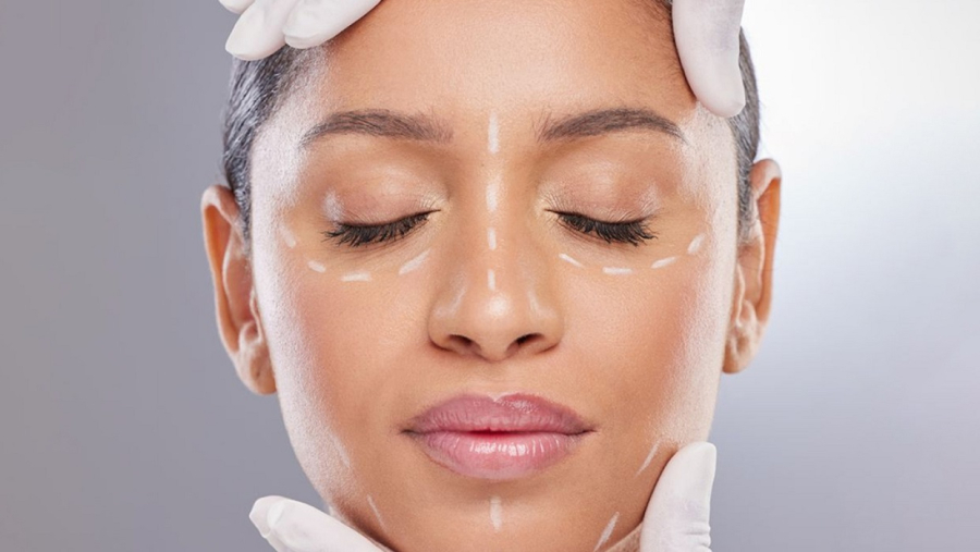 Βοτουλινική τοξίνη: Συμβουλές μετά τη θεραπεία για βέλτιστο αποτέλεσμα