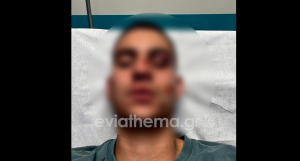 Χαλκίδα: Άγριος ξυλοδαρμός 19χρονου για ένα like στο Facebook – Στο νοσοκομείο με σοβαρά τραύματα